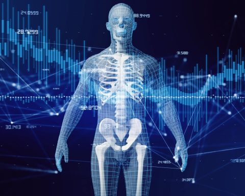 Whole-Body Vibration (WBV)